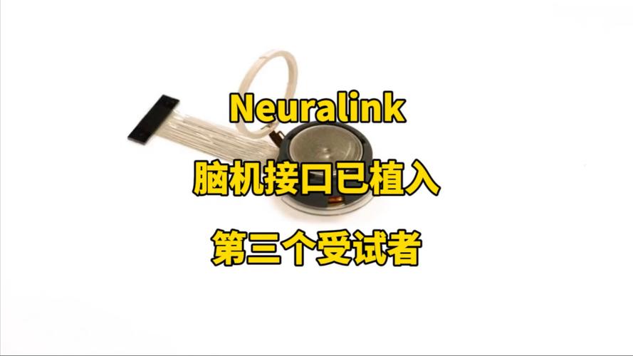 埃隆马斯克芯片植入大脑的影响_马斯克发明植入脑机接口_Neuralink的巨大发展目标：马斯克确认2025年将为20至30例患者植入脑机技术